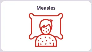 Measles in Early Childhood: Causes, Impacts, and Prevention