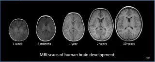 Brain Development