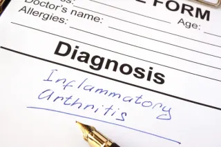 Exploring Arthritis Diagnosis