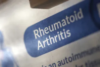 Gaining Insight into Rheumatoid Arthritis Flare-Ups