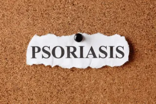 Psoriasis and Joint Pain: New Insights on Psoriatic Arthritis from Groundbreaking Study