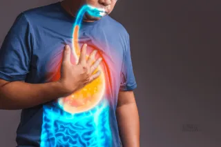GERD and Rheumatoid Arthritis: A Surprising Connection That Could Protect Your Joints