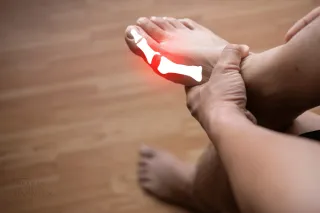 The Silent Struggle of Gout: Why Many Flares Go Unreported