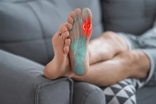 Millions of Americans Struggle with Gout: The Ongoing Challenge of Treatment Adherence