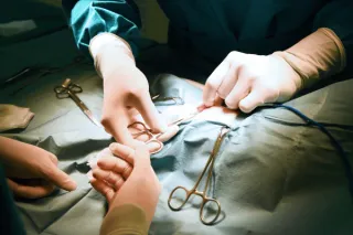Early ACL Surgery May Help Prevent Knee Arthritis, New Study Finds