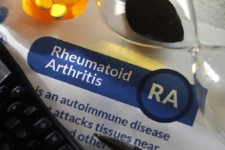 Scientific Breakthrough Unveils Promising New Path for Rheumatoid Arthritis Treatment
