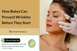 How Botox Can Prevent Wrinkles Before They Start