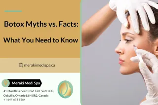 Botox Myths vs. Facts – What You Need to Know