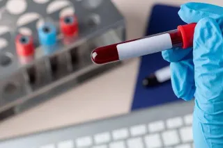 How Blood Work Uncovers Hidden Causes of Anxiety & Depression