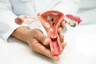 PCOS Unraveled: Causes, Symptoms & Solutions | The Functional MDs Clinic, Carmel IN
