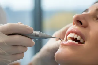 Best Cosmetic Treatments for Stained Teeth That Actually Restore a Bright Smile