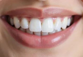 The Complete Guide to Porcelain Veneers for Stunning Smile Makeovers