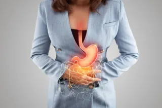 Acid reflux, Heartburn, and GERD