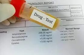 Understanding Split Specimen Testing in Drug Screening