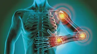 Body Inflammation 101