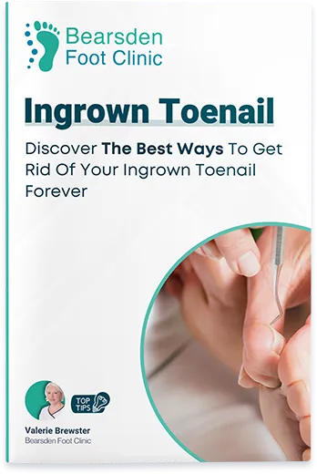 How to Get Rid of an Ingrown Toenail: Removal and Remedies - Dr. Axe