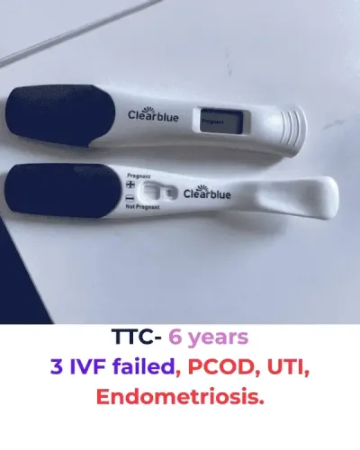 Ovarian cyst resolved naturally