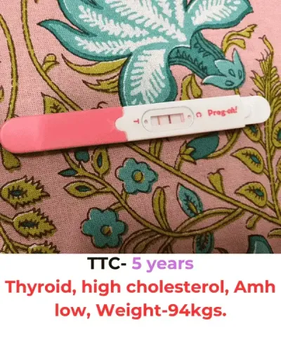 PCOS natural pregnancy success