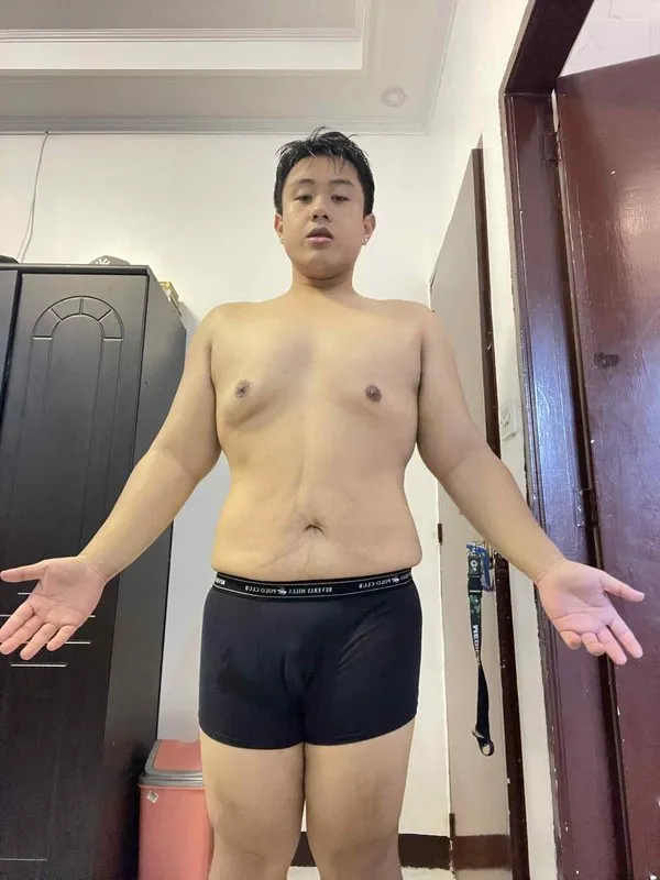 Jon after