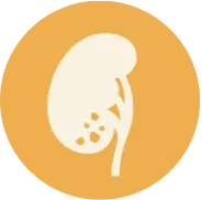 Kidney Stone Management