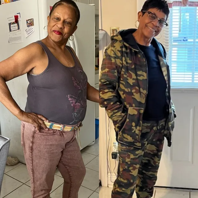 Original side-by-side comparison of a woman in casual clothing, supplied by The Royal Formula
