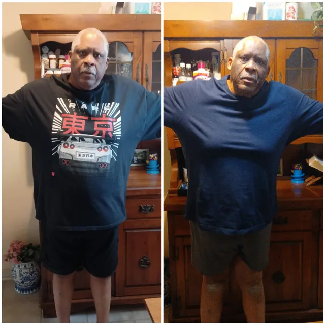 Original side-by-side comparison of a man in casual clothing, supplied by The Royal Formula