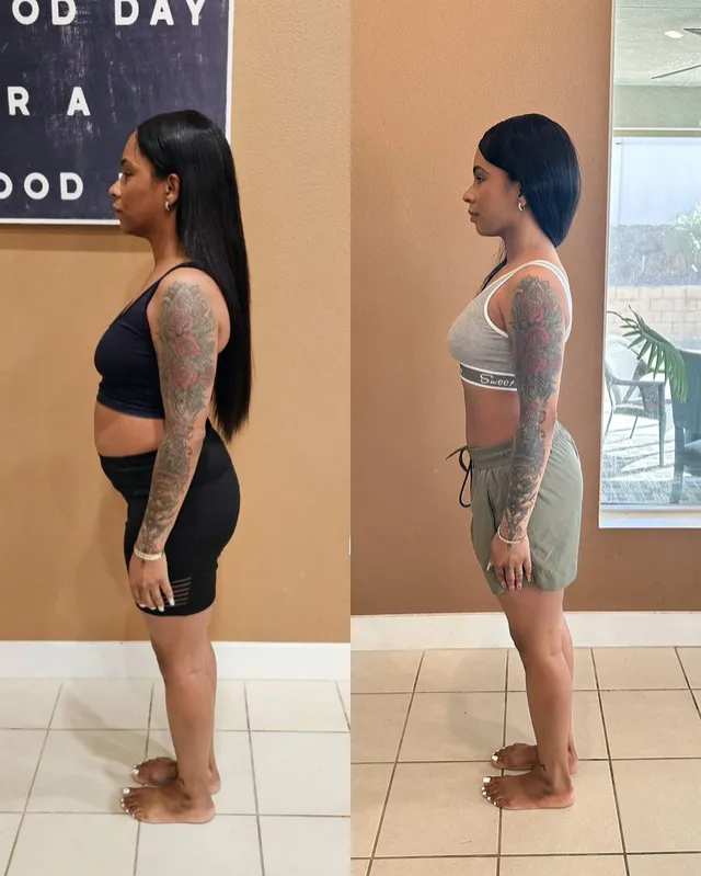 Original side-by-side comparison of a woman standing in profile, supplied by The Royal Formula