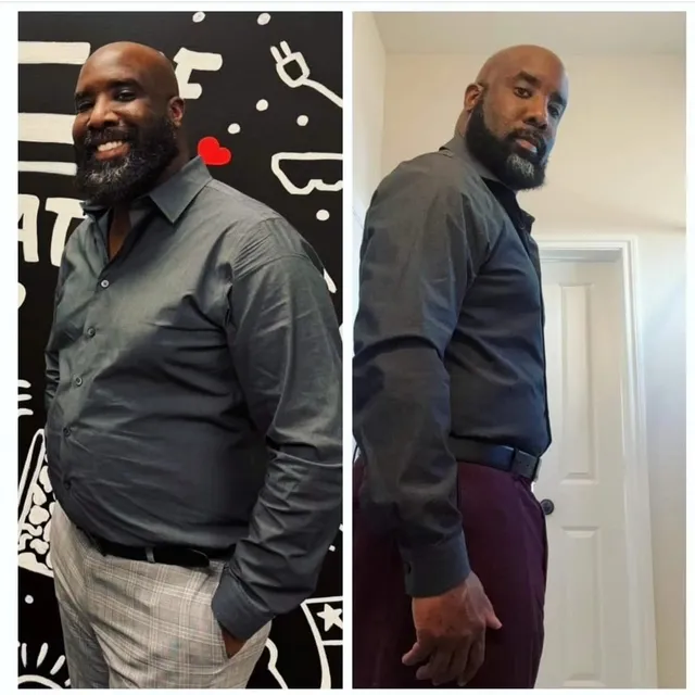 Original intact comparison of a man in a grey shirt, shared by The Royal Formula on Instagram in March 2024