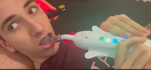 Child receiving cerebellar stimulation therapy — oral vibration and eye movement techniques for brain development in children with autism and ADHD