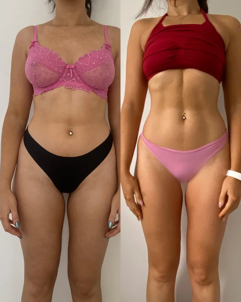 Shields-Fit client before and after