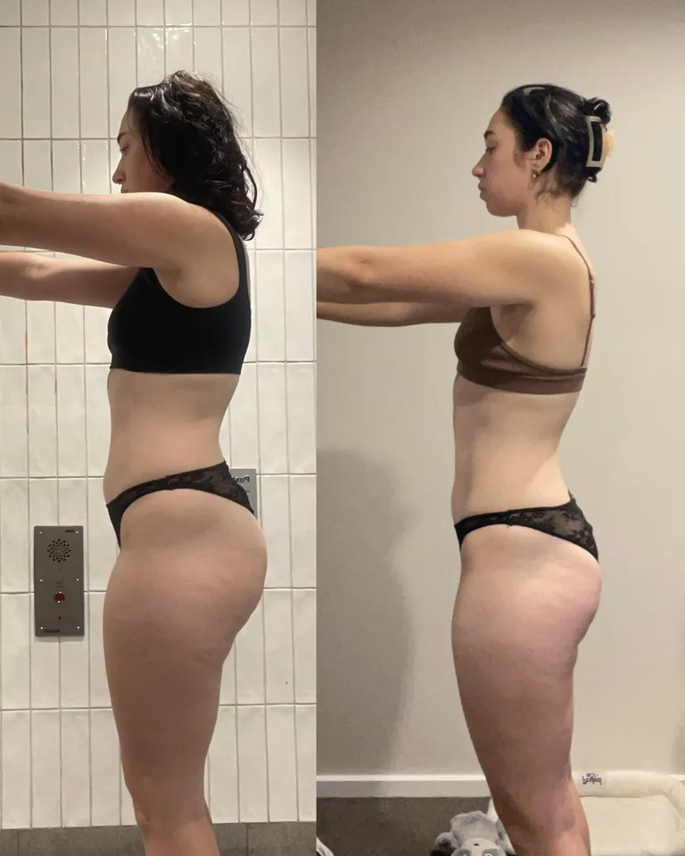 Shields-Fit client before and after