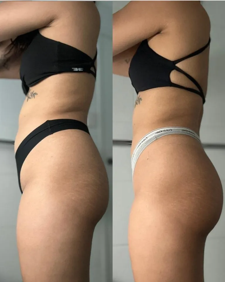Shields-Fit client before and after