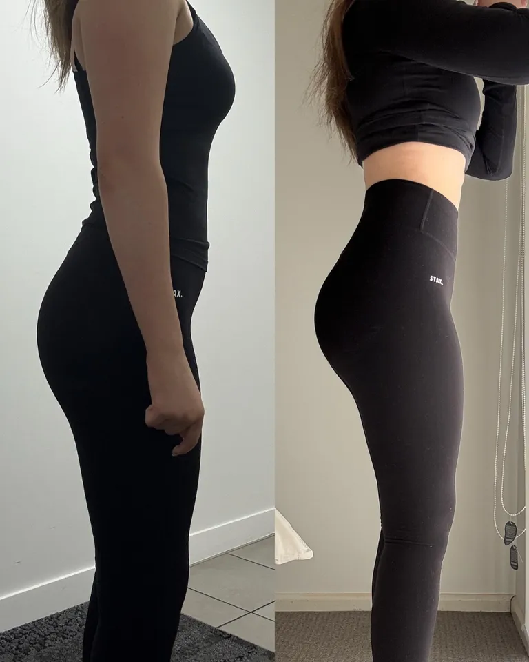 Shields-Fit client before and after
