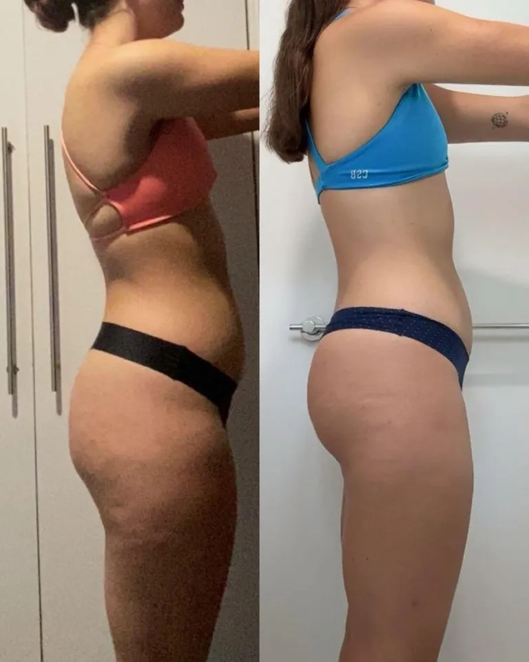Shields-Fit client before and after