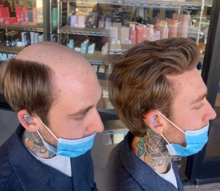 Hair transformation result