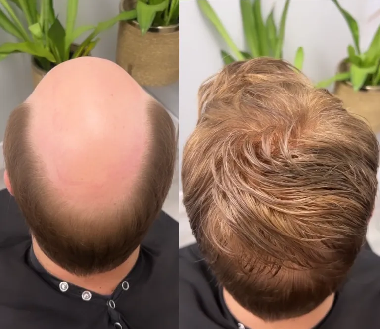 Hair transformation result