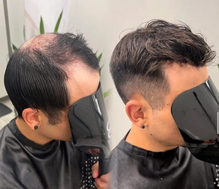 Hair transformation result