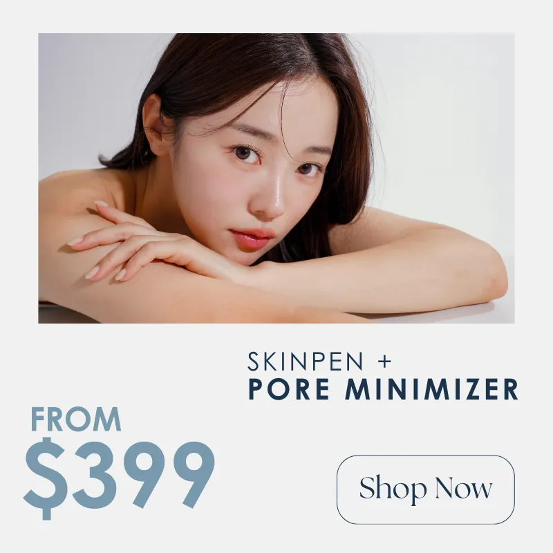 Microneedling + Pore Treatment