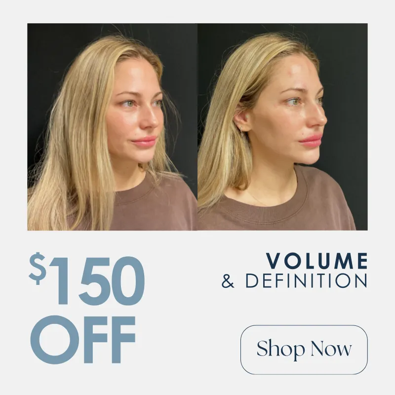 Filler | $150 OFF
