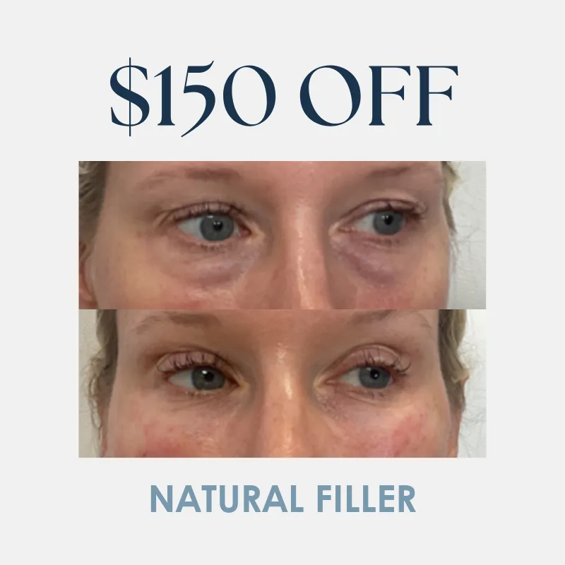 PRF | $150 OFF