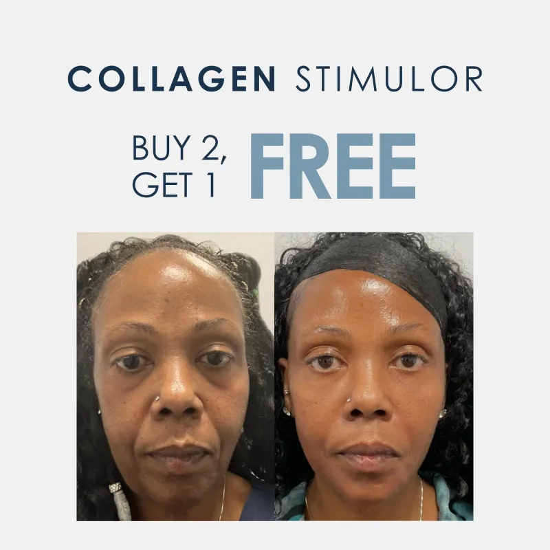 Sculptra® | Buy 2, Get 1 FREE