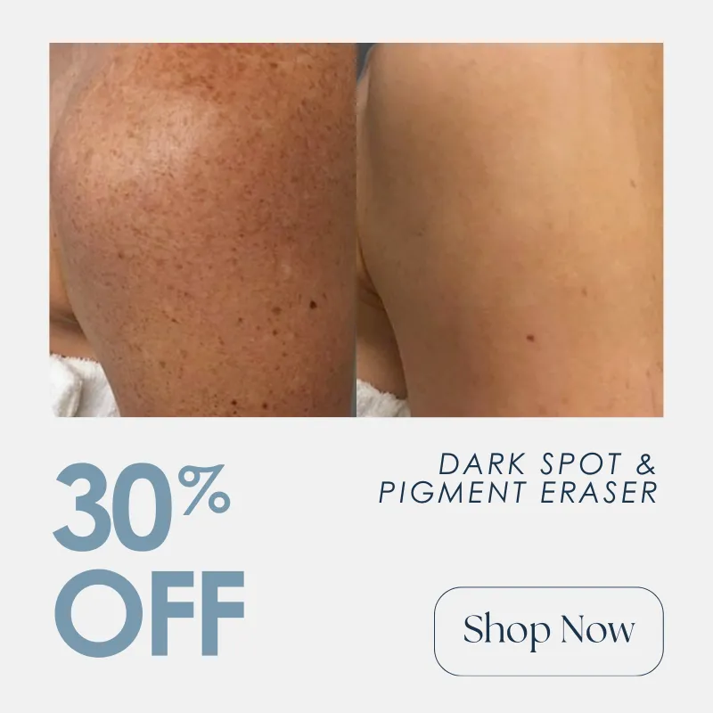 IPL | 30% OFF