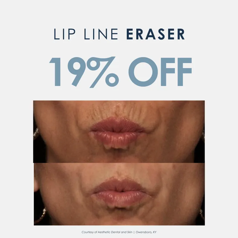 Lip Line Eraser | "Smokers Lines"
