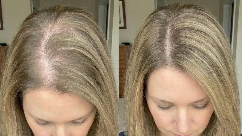 Joanna M. — result after 90 days