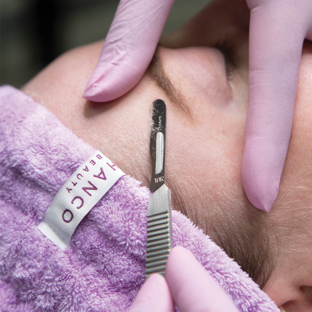 Dermaplaning