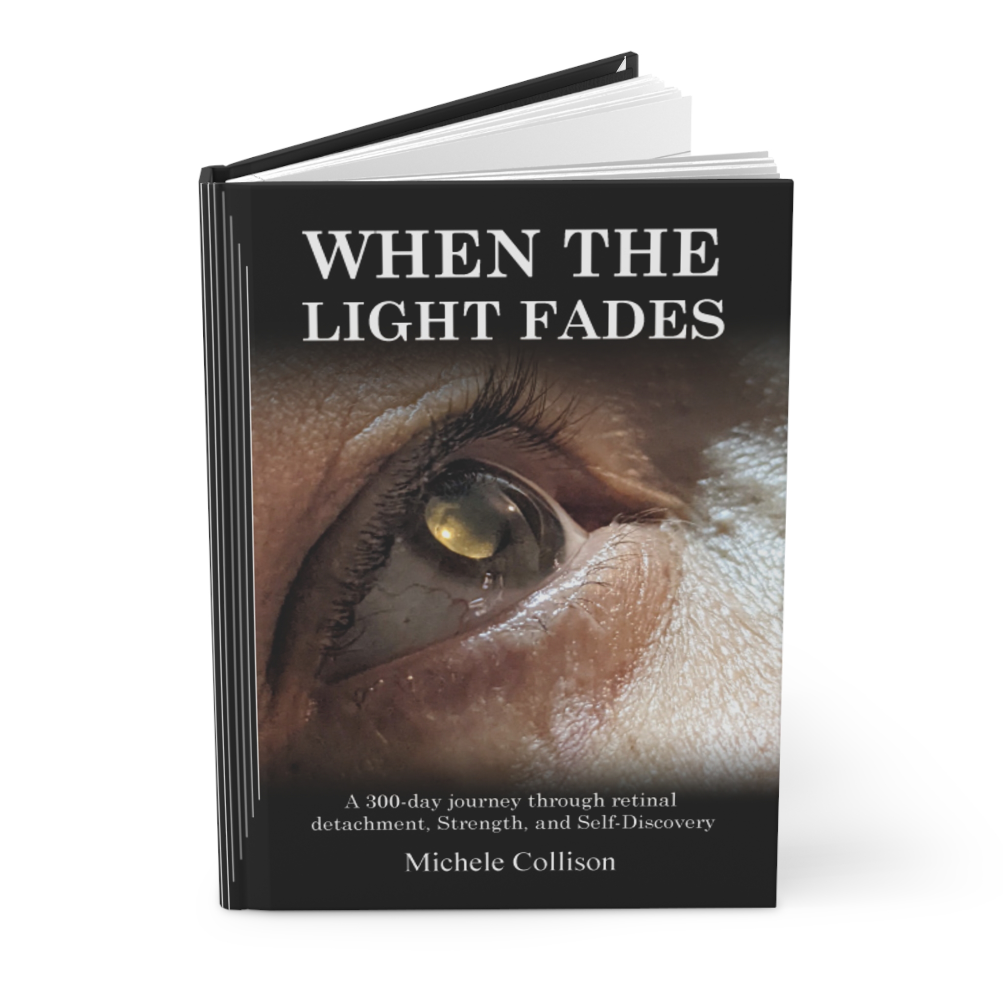When The Light Fades, A 300-day journey through retinal detachment