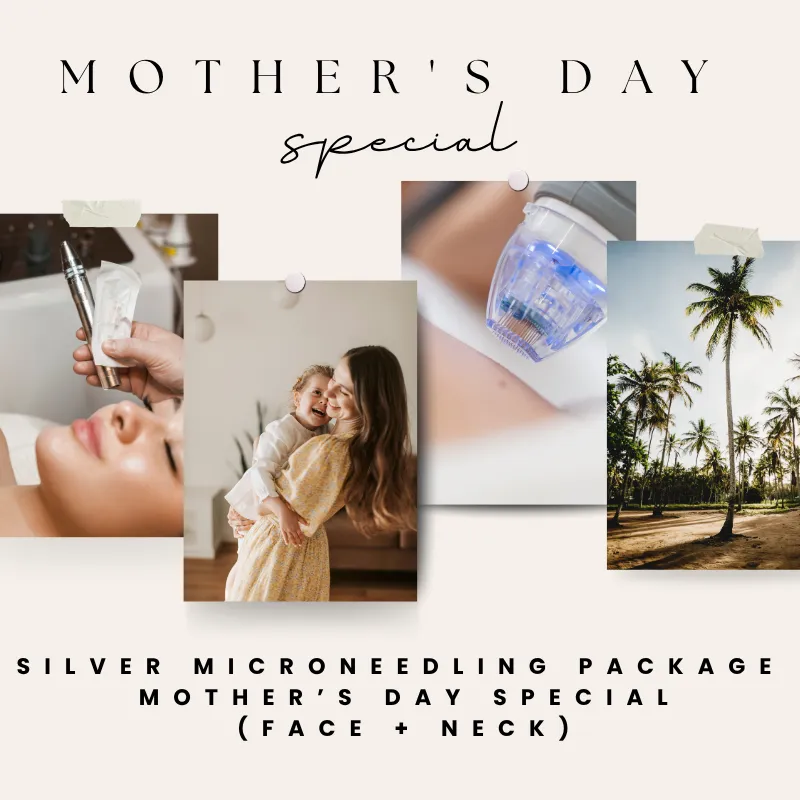 Silver Mother’s Day Microneedling Package (Full Face + Neck, Package of 3)
