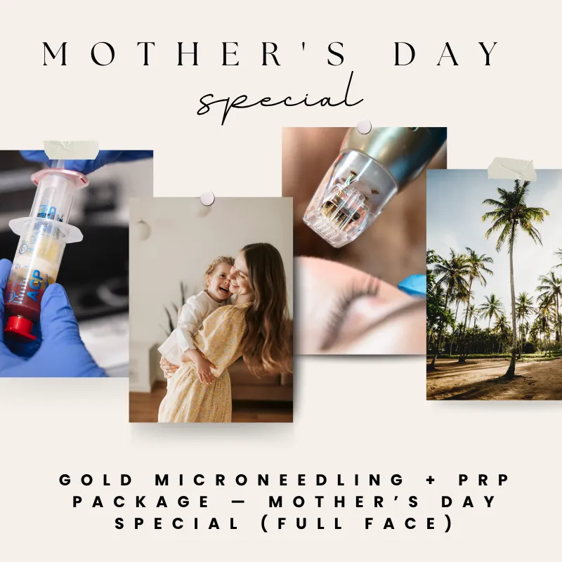Gold Mother’s Day Microneedling Package (Full Face + PRP, Package of 3)