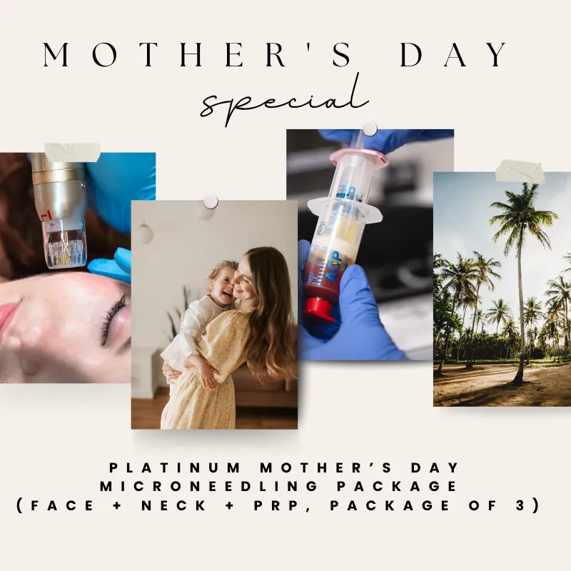 Platinum Mother’s Day Microneedling Package (Face + Neck + PRP, Package of 3)