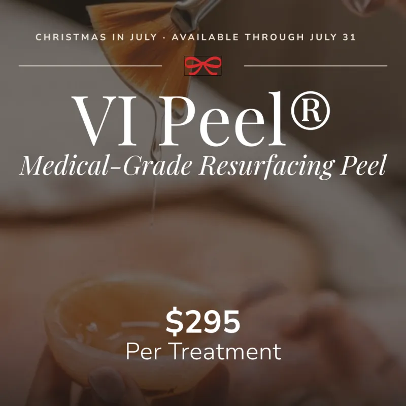 VI Peel | Christmas in July Special